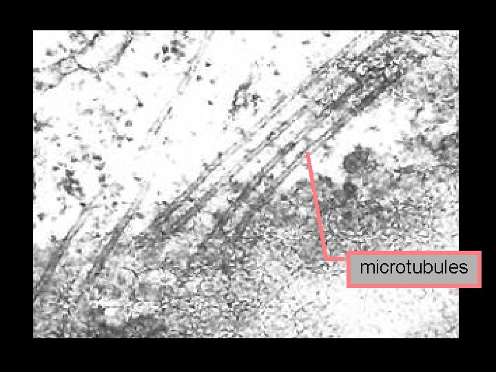 microtubules 