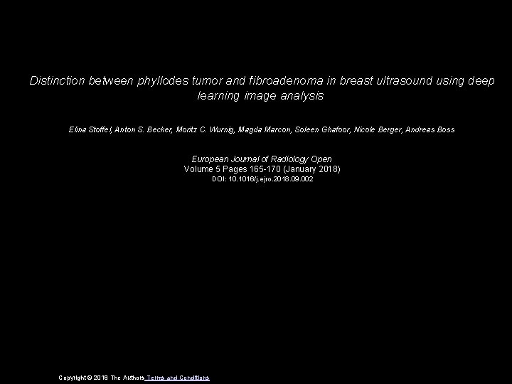 Distinction between phyllodes tumor and fibroadenoma in breast ultrasound using deep learning image analysis
