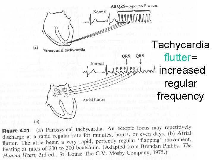 Tachycardia flutter= increased regular frequency Tachycardia flutter= increased regular frequency