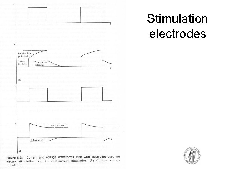 Stimulation electrodes Stimulation electrodes