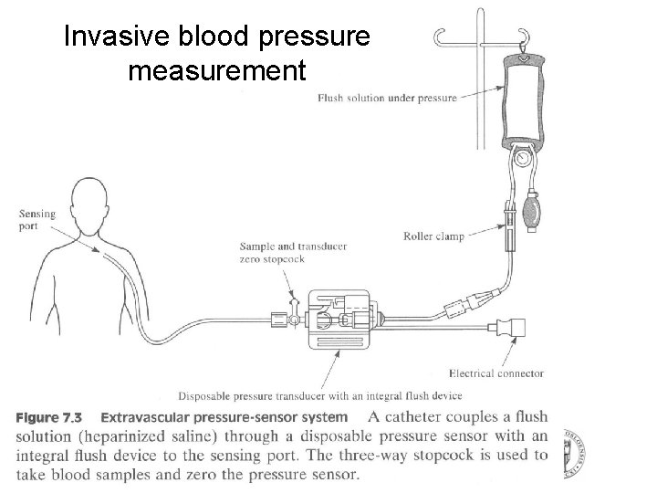 Invasive blood pressure measurement Invasive blood pressure measurement
