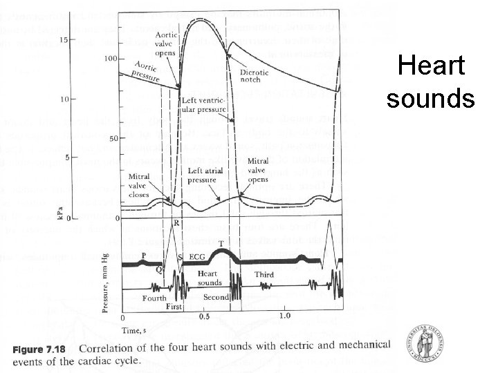 Heart sounds Heart sounds