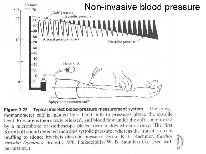 Non-invasive blood pressure Non-invasive blood pressure