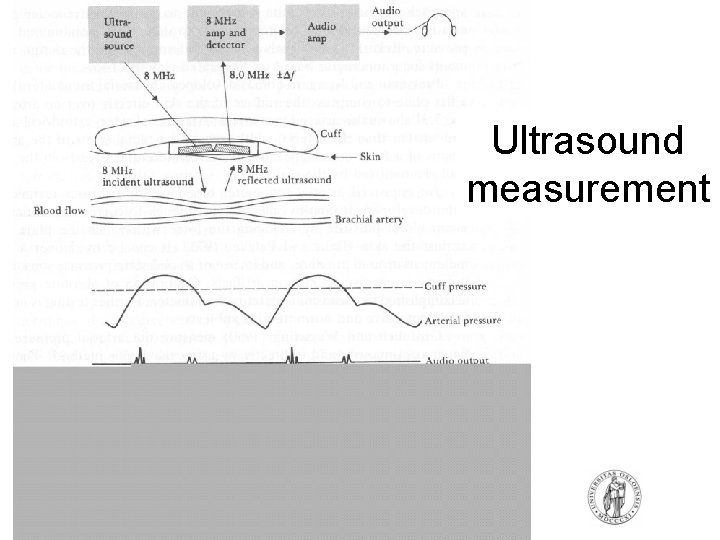 Ultrasound measurement Ultrasound measurement