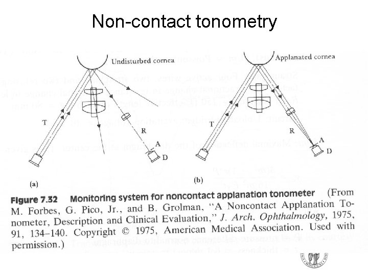 Non-contact tonometry Non-contact tonometry