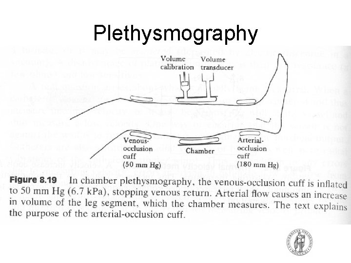 Plethysmography Plethysmography