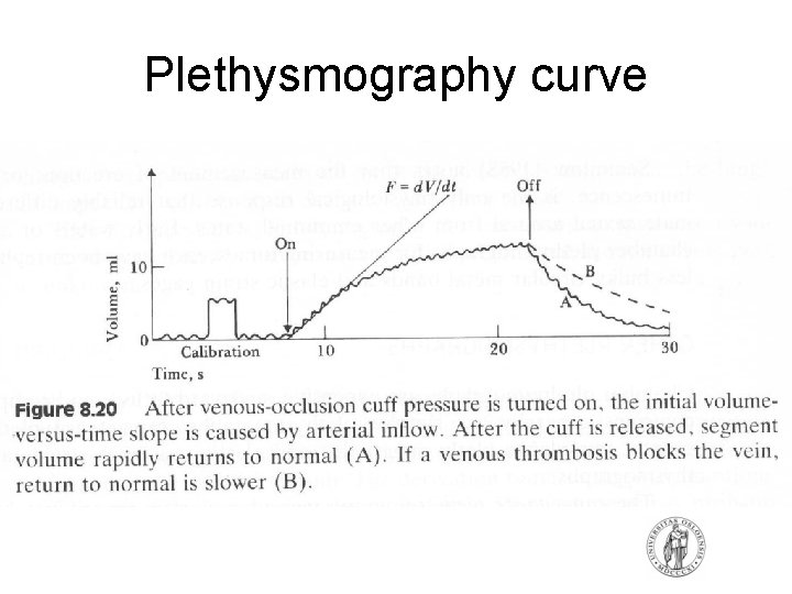 Plethysmography curve Plethysmography curve