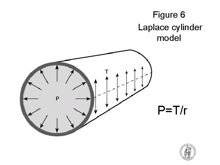 Figure 6 Laplace cylinder model P=T/r Figure 6 Laplace cylinder model P=T/r