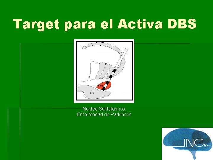Target para el Activa DBS Nucleo Subtalamico: Enfermedad de Parkinson 