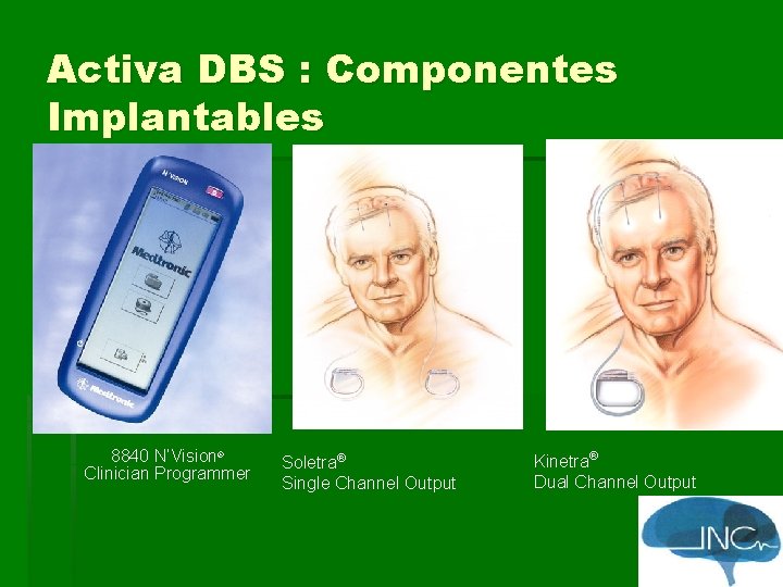 Activa DBS : Componentes Implantables 8840 N’Vision® Clinician Programmer Soletra® Single Channel Output Kinetra®
