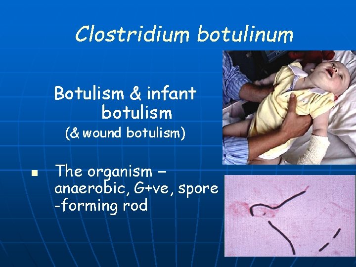Clostridium botulinum Botulism & infant botulism (& wound botulism) n The organism – anaerobic,
