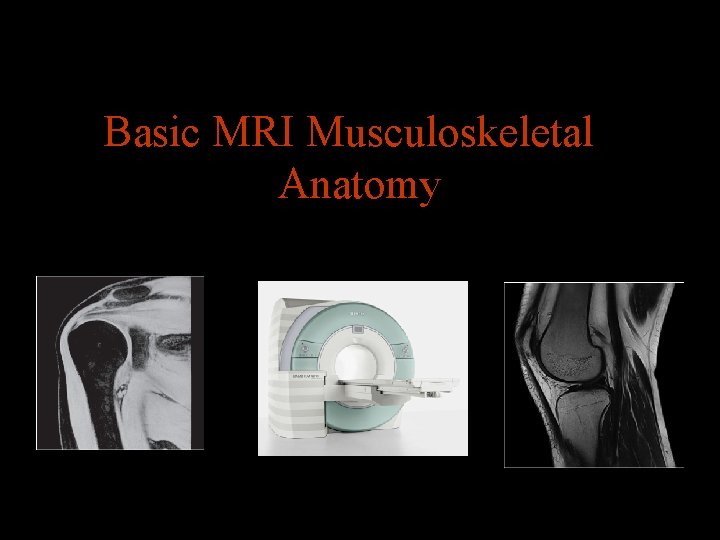 Basic MRI Musculoskeletal Anatomy 