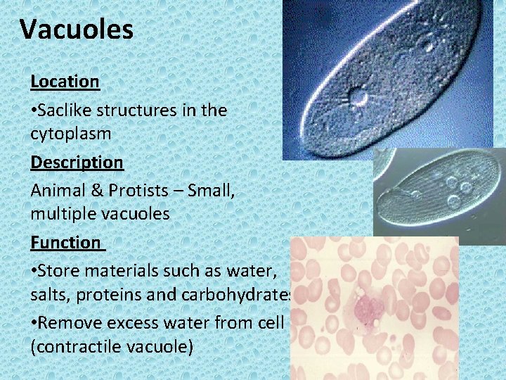 Vacuoles Location • Saclike structures in the cytoplasm Description Animal & Protists – Small,