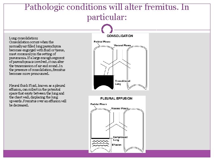 Pathologic conditions will alter fremitus. In particular: Lung consolidation: Consolidation occurs when the normally