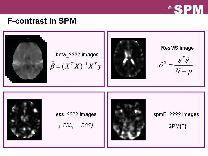 F-contrast in SPM Res. MS image beta_? ? images ess_? ? images spm. F_?