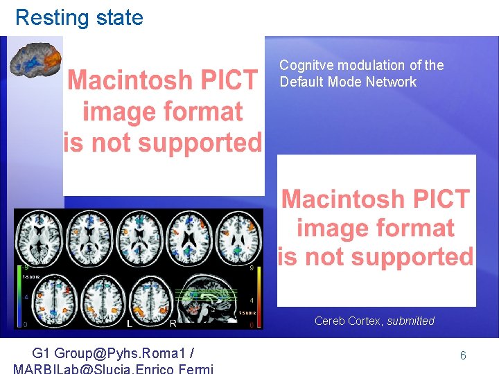 Resting state Cognitve modulation of the Default Mode Network t-score G 1 Group@Pyhs. Roma