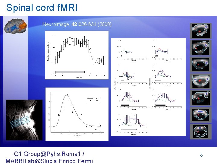 Spinal cord f. MRI Neuroimage, 42: 626 -634 (2008) G 1 Group@Pyhs. Roma 1