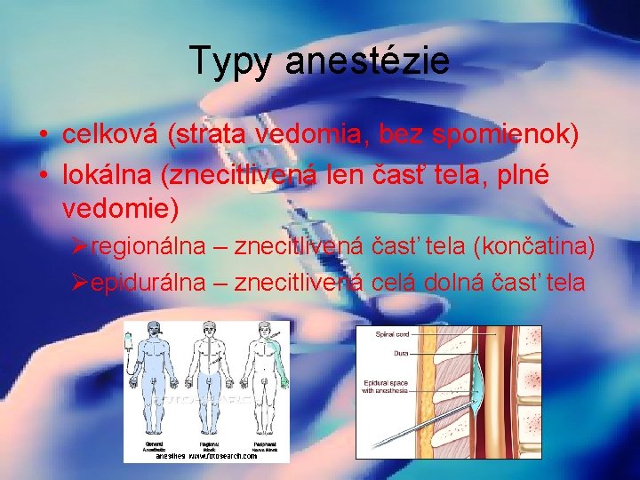 Typy anestézie • celková (strata vedomia, bez spomienok) • lokálna (znecitlivená len časť tela,