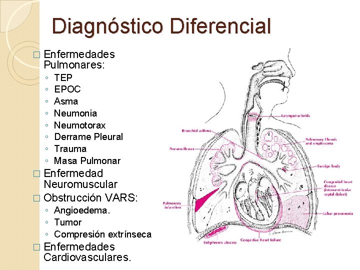 Diagnóstico Diferencial � Enfermedades Pulmonares: ◦ ◦ ◦ ◦ TEP EPOC Asma Neumonia Neumotorax Diagnóstico Diferencial � Enfermedades Pulmonares: ◦ ◦ ◦ ◦ TEP EPOC Asma Neumonia Neumotorax