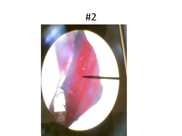 #2 #2