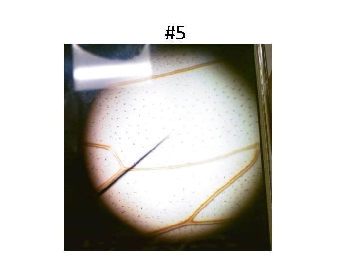 #5 #5