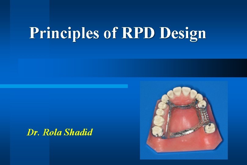 Principles of RPD Design Dr. Rola Shadid 