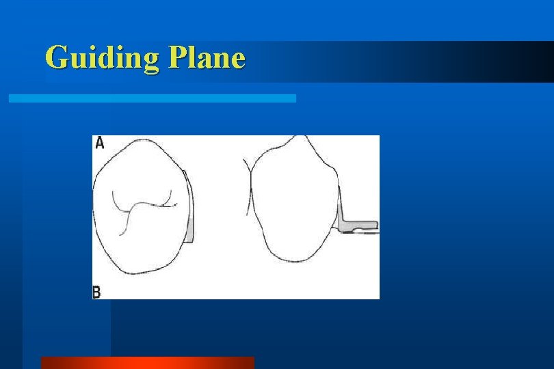 Guiding Plane 