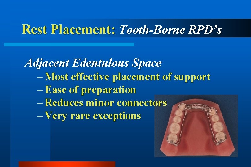 Rest Placement: Tooth-Borne RPD’s Adjacent Edentulous Space – Most effective placement of support –