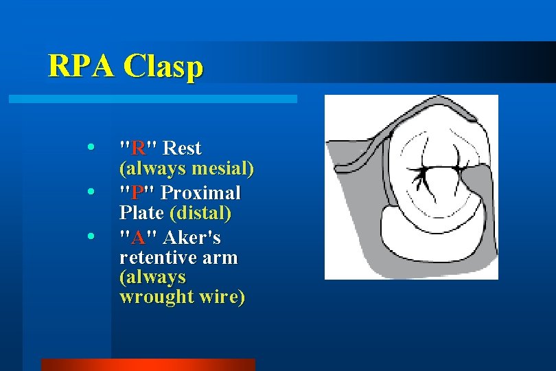 RPA Clasp "R" Rest (always mesial) "P" Proximal Plate (distal) "A" Aker's retentive arm