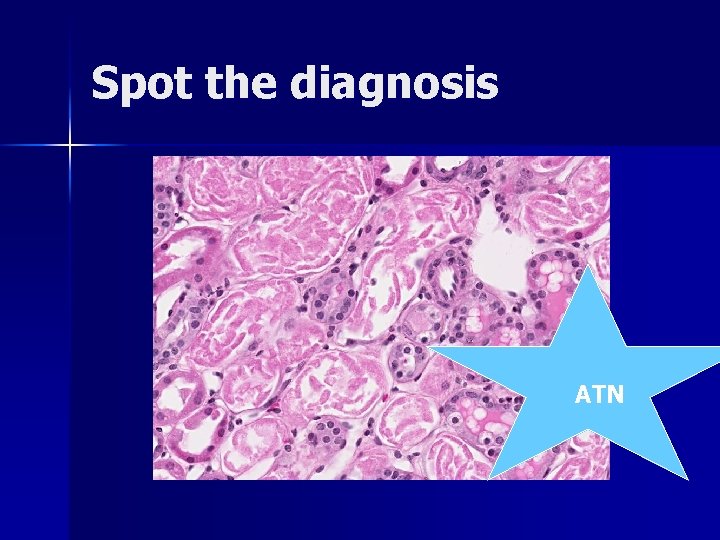 Spot the diagnosis ATN 