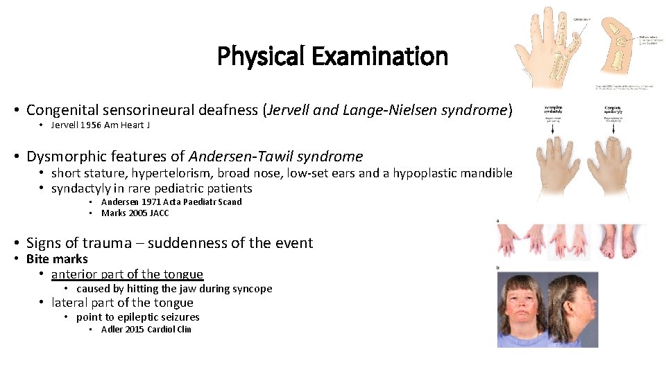 Physical Examination • Congenital sensorineural deafness (Jervell and Lange-Nielsen syndrome) • Jervell 1956 Am