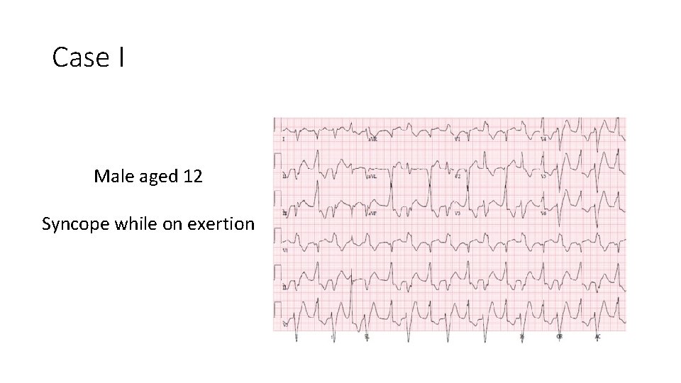 Case I Male aged 12 Syncope while on exertion 