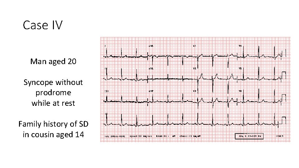 Case IV Man aged 20 Syncope without prodrome while at rest Family history of