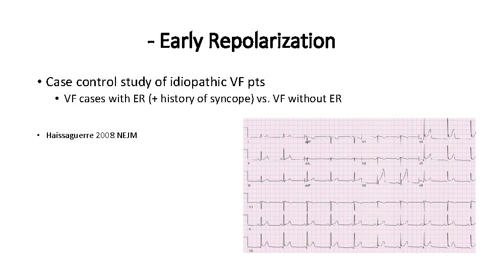 - Early Repolarization • Case control study of idiopathic VF pts • VF cases