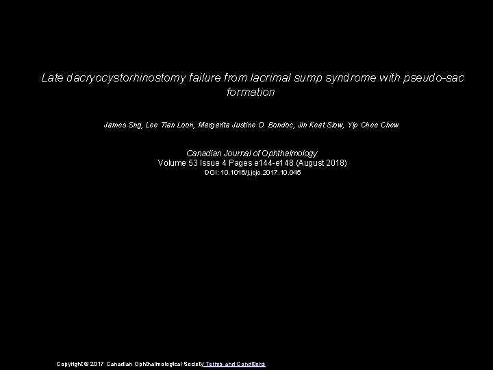 Late dacryocystorhinostomy failure from lacrimal sump syndrome with pseudo-sac formation James Sng, Lee Tian