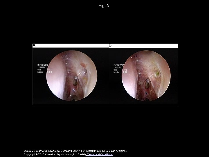 Fig. 5 Canadian Journal of Ophthalmology 2018 53 e 144 -e 148 DOI: (10.