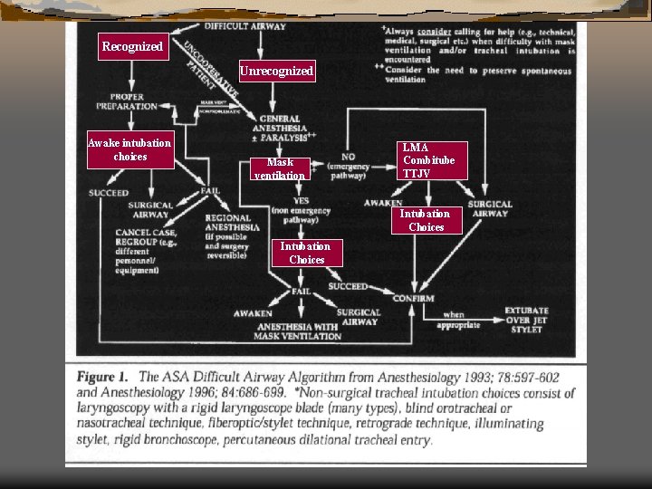 Recognized Unrecognized Awake intubation choices Mask ventilation LMA Combitube TTJV Intubation Choices Recognized Unrecognized Awake intubation choices Mask ventilation LMA Combitube TTJV Intubation Choices
