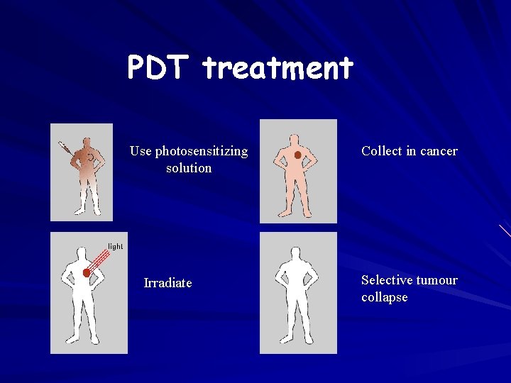 PDT treatment Use photosensitizing solution Irradiate Collect in cancer Selective tumour collapse 