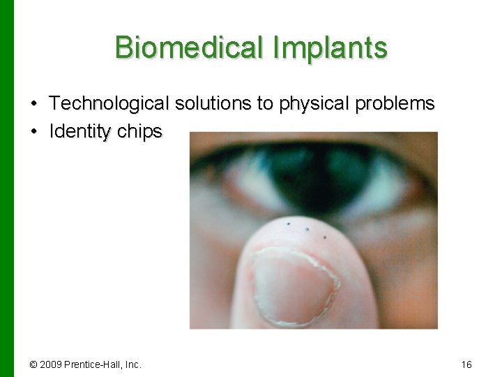 Biomedical Implants • Technological solutions to physical problems • Identity chips © 2009 Prentice-Hall,