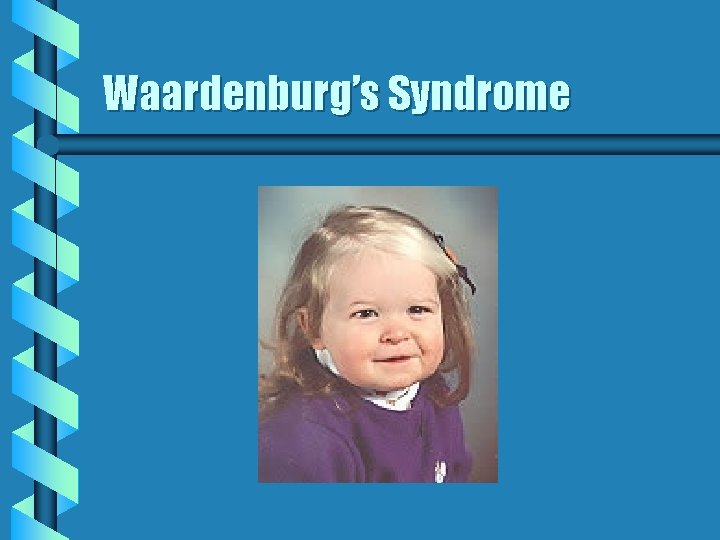 Waardenburg’s Syndrome Waardenburg’s Syndrome