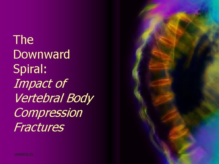 The Downward Spiral: Impact of Vertebral Body Compression Fractures 16000038 -02 
