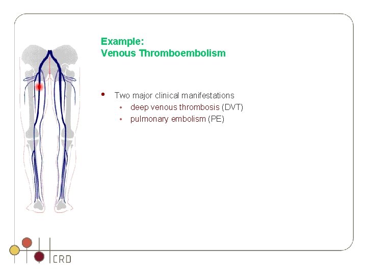 Example: Venous Thromboembolism • Two major clinical manifestations • deep venous thrombosis (DVT) • Example: Venous Thromboembolism • Two major clinical manifestations • deep venous thrombosis (DVT) •