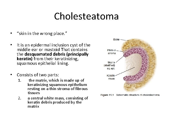 Cholesteatoma • “skin in the wrong place. ” • It is an epidermal inclusion