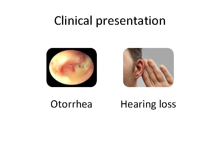 Clinical presentation Otorrhea Hearing loss 