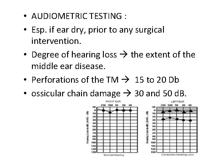  • AUDIOMETRIC TESTING : • Esp. if ear dry, prior to any surgical