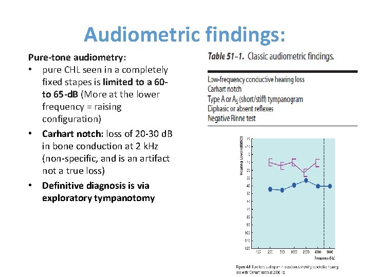 Audiometric findings: Pure-tone audiometry: • pure CHL seen in a completely fixed stapes is