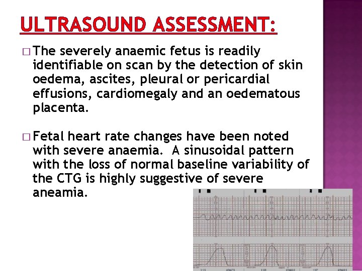 ULTRASOUND ASSESSMENT: � The severely anaemic fetus is readily identifiable on scan by the