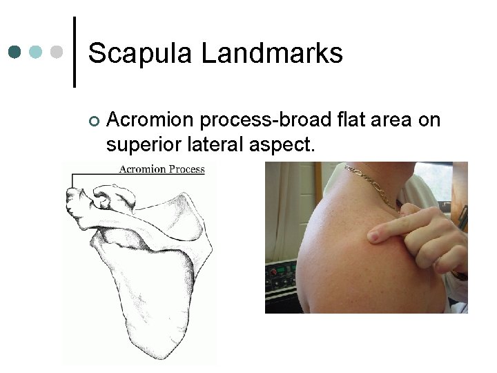 Scapula Landmarks ¢ Acromion process-broad flat area on superior lateral aspect. 