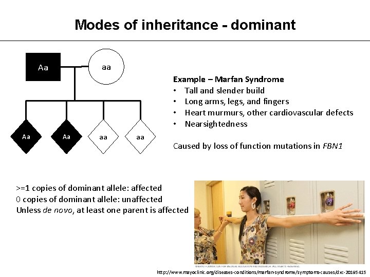 Modes of inheritance - dominant aa Aa Example – Marfan Syndrome • Tall and