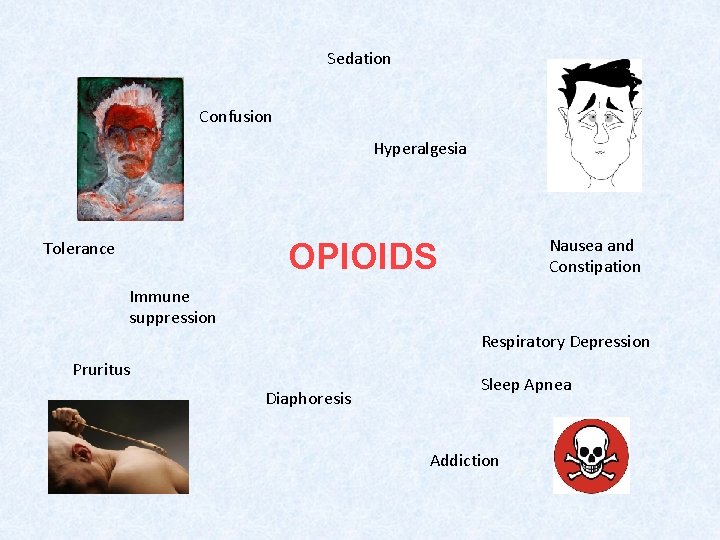 Sedation Confusion Hyperalgesia Nausea and Constipation OPIOIDS Tolerance Immune suppression Respiratory Depression Pruritus Diaphoresis
